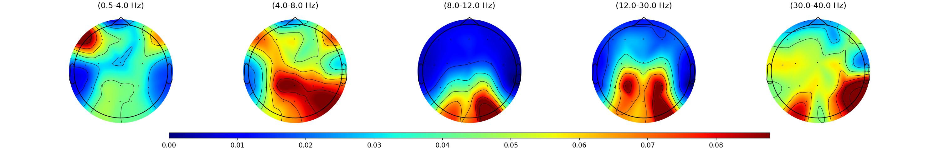 Topografia espectral QEEG por banda no Lúcida EEG